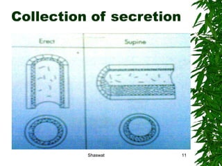 Collection of secretion Shaswat Shaswat 
