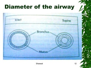 Diameter of the airway Shaswat Shaswat 