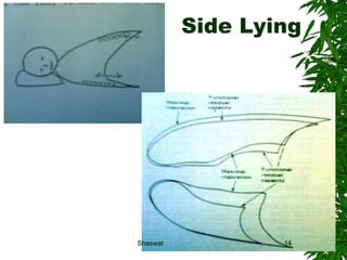 Side Lying Shaswat Shaswat 