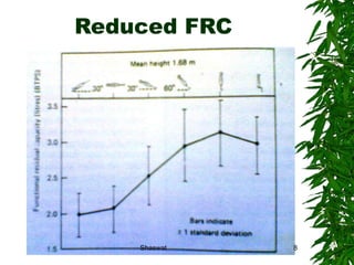 Reduced FRC Shaswat Shaswat 