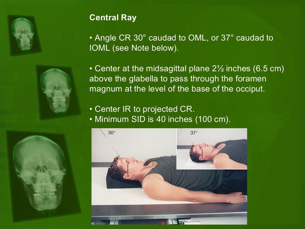 Positioning and radiographic anatomy of the skull