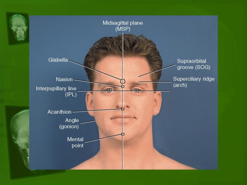 Positioning and radiographic anatomy of the skull