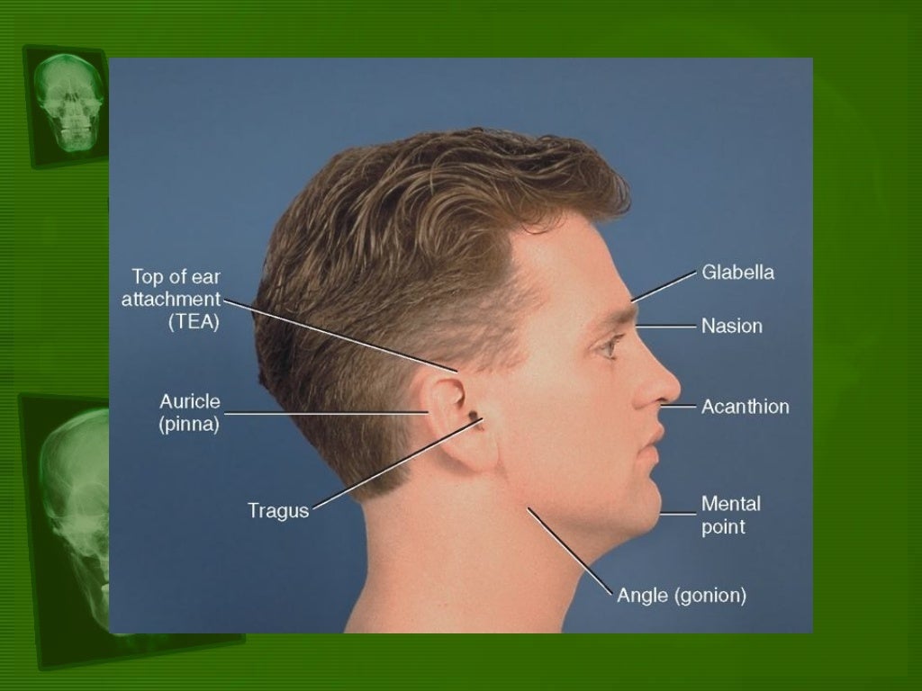 Positioning and radiographic anatomy of the skull