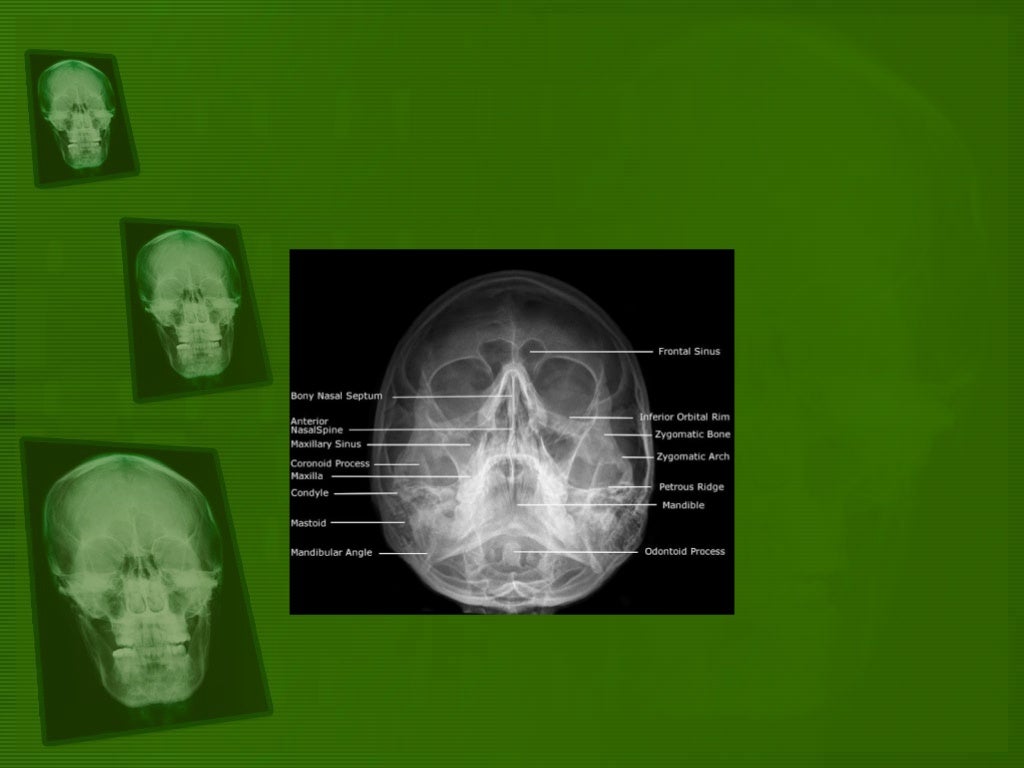 Positioning and radiographic anatomy of the skull