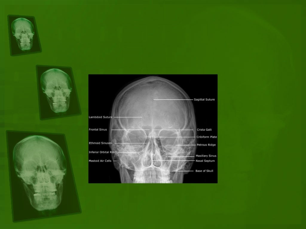 Positioning and radiographic anatomy of the skull