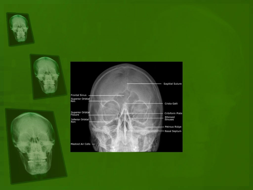 Positioning and radiographic anatomy of the skull