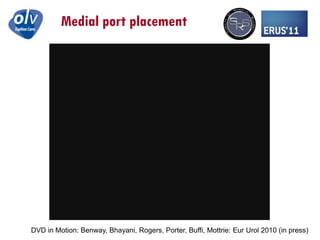 Positioning Ports for Robotic Partial Nephrectomy Challacombe | PPTX
