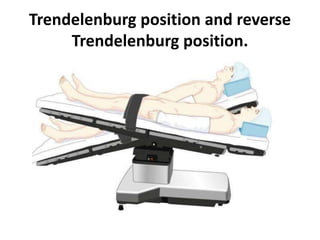 Trendelenburg position and reverse
Trendelenburg position.
 