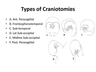 Types of Craniotomies
• A. Ant. Parasagittal
• B. Frontosphenotemporal
• C. Sub‐temporal
• D. Lat Sub‐occipital
• E. Midline Sub‐occipital
• F. Post. Parasagittal
 