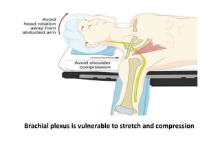 Brachial plexus is vulnerable to stretch and compression
 