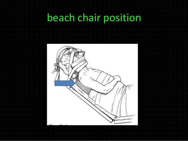 Positioning In Anaesthesia Mgmc Positioning In Anaesthesia Mgmc
