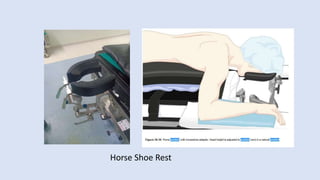 Horse Shoe Rest
 