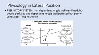 Physiology in Lateral Position
• RESPIRATORY SYSTEM: non dependent lung is well ventilated, but
poorly perfused and dependent lung is well perfused but poorly
ventilated - V/Q mismatch
 