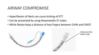 AIRWAY COMPROMISE
• Hyperflexion of Neck can cause kinking of ETT
• Can be prevented by using flexometallic ET tubes
• While flexion keep a distance of two fingers between CHIN and CHEST
STAINLESS STEEL
SPIRAL CORE
 
