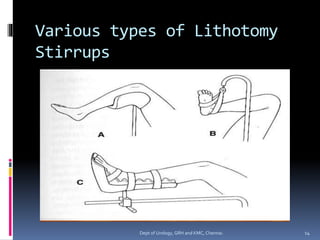 Various types of Lithotomy
Stirrups
14
Dept of Urology, GRH and KMC, Chennai.
 