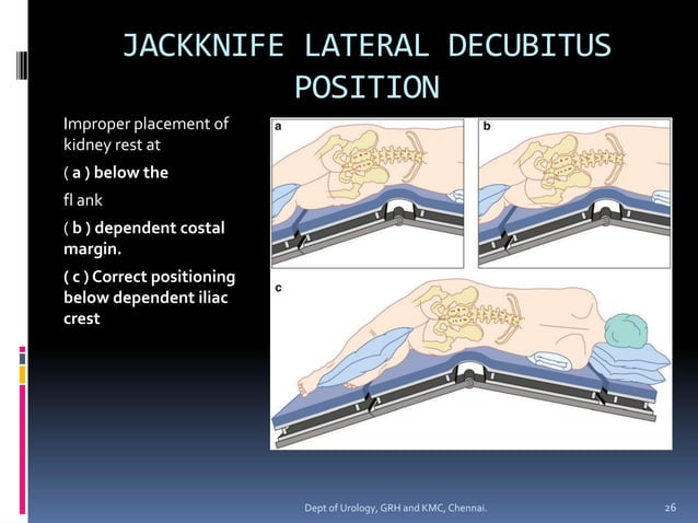 Positioning in urological procedures | PDF