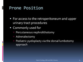 Prone Position
▪ For access to the retroperitoneum and upper
urinary tract procedures
▪ Commonly used for
 Percutaneous nephrolithotomy
 Adrenalectomy
 Pediatric pyeloplasty via the dorsal lumbotomy
approach
32
Dept of Urology, GRH and KMC, Chennai.
 