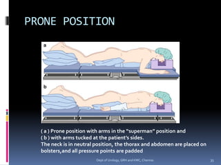 PRONE POSITION
( a ) Prone position with arms in the “superman” position and
( b ) with arms tucked at the patient’s sides.
The neck is in neutral position, the thorax and abdomen are placed on
bolsters,and all pressure points are padded
35
Dept of Urology, GRH and KMC, Chennai.
 