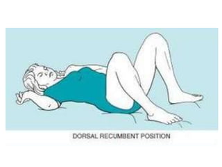 Dorsal Recumbent Position