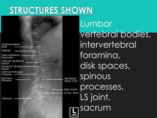 POSITIONING OF LUMBOSACRAL SPINE - new.pptx