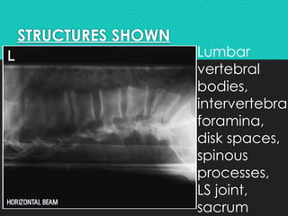 POSITIONING OF LUMBOSACRAL SPINE - new.pptx