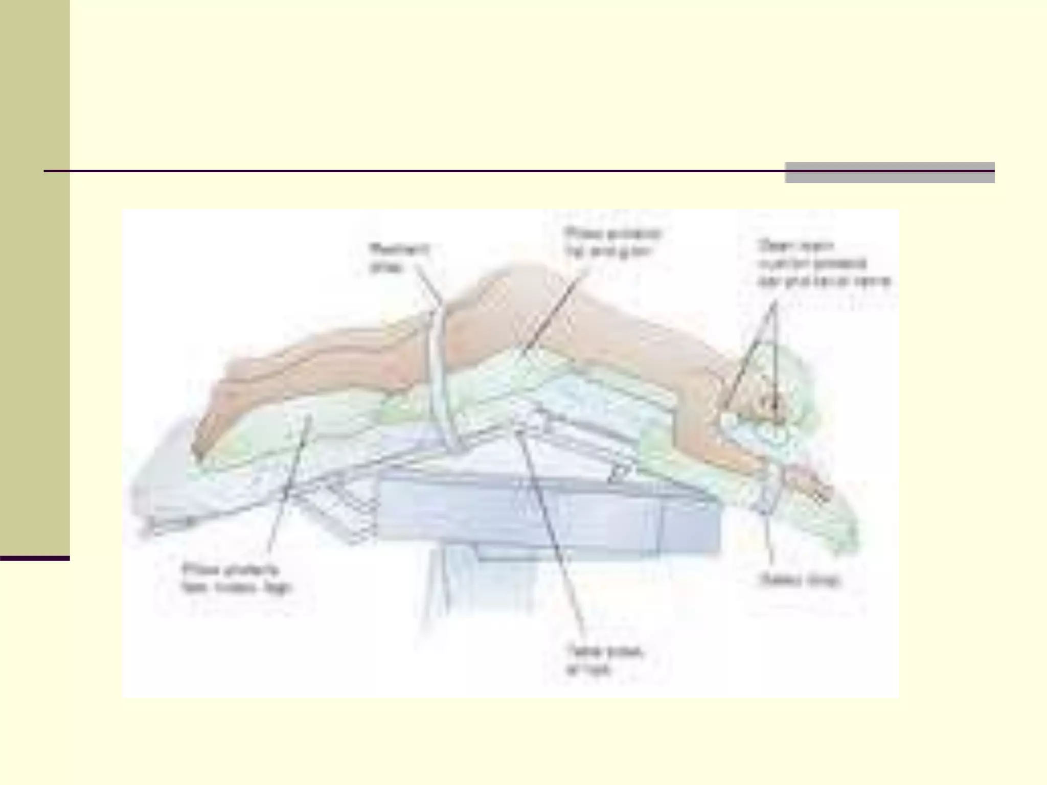 Positioning of patient during surgery | PPTX