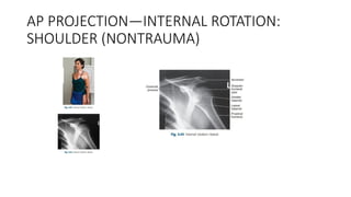 positioning orthopaedic xray capture(1).pptx