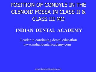 POSITION OF CONDYLE IN THE
GLENOID FOSSA IN CLASS II &
CLASS III MO
INDIAN DENTAL ACADEMY
Leader in continuing dental education
www.indiandentalacademy.com

www.indiandentalacademy.com

 