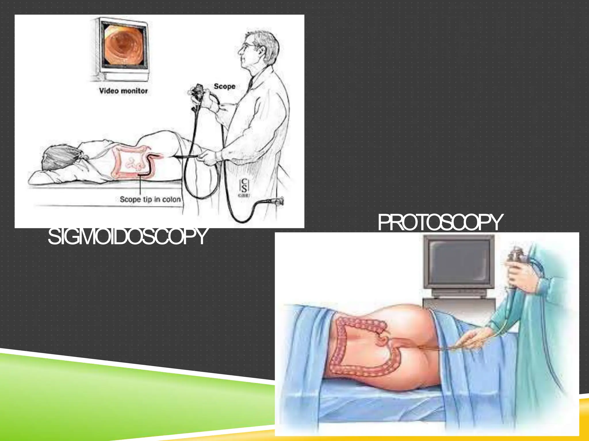 Proctological Position positioning of patient | PDF