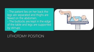 - The patient lies on her back the
legs are separated and thighs are
flexed on the abdomen.
- The buttocks are kept in the edge
of the table and legs are supported
by stirrups
LITHOTOMY POSITION
 