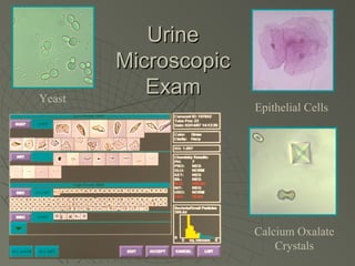 Urine
        Microscopic
Yeast
           Exam
                      Epithelial Cells




                      Calcium Oxalate
                          Crystals
 