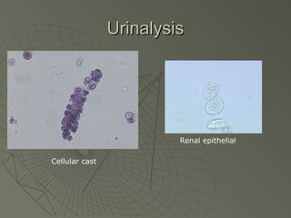 Urinalysis




                         Renal epithelial

Cellular cast
 