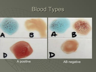 Blood Types




A positive             AB negative
 