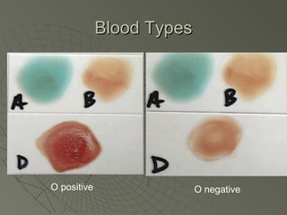 Blood Types




O positive                 O negative
 