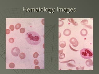 Hematology Images
 