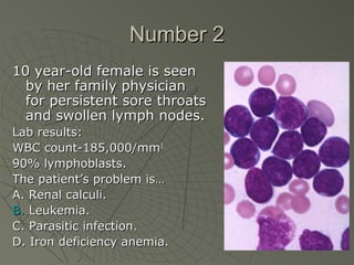Number 2
10 year-old female is seen
  by her family physician
  for persistent sore throats
  and swollen lymph nodes.
Lab results:
WBC count-185,000/mm3.
90% lymphoblasts.
The patient’s problem is…
A. Renal calculi.
B. Leukemia.
C. Parasitic infection.
D. Iron deficiency anemia.
 