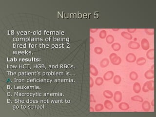 Number 5
18 year-old female
  complains of being
  tired for the past 2
  weeks.
Lab results:
Low HCT, HGB, and RBCs.
The patient’s problem is….
A. Iron deficiency anemia.
B. Leukemia.
C. Macrocytic anemia.
D. She does not want to
  go to school.
 