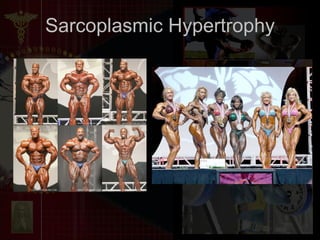 Sarcoplasmic Hypertrophy 