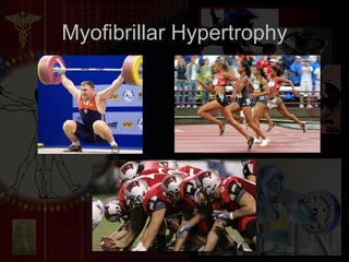 Myofibrillar Hypertrophy 