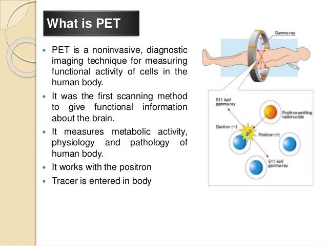 positron emission tomography pet how a pet scan works