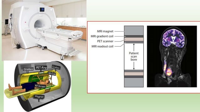 Positron emission tomography pet scan and its applications | PPTX