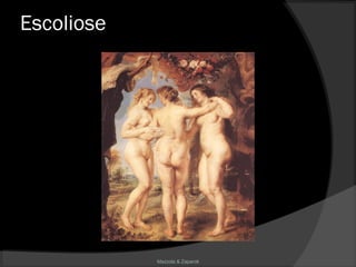 Mazzola & Zaparoli
Escoliose
 