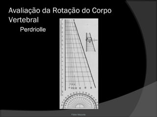 Fábio Mazzola
Avaliação da Rotação do Corpo
Vertebral
Perdriolle
 