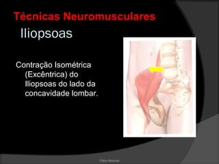 Fábio Mazzola
Iliopsoas
Contração Isométrica
(Excêntrica) do
Iliopsoas do lado da
concavidade lombar.
Técnicas NeuromuscularesTécnicas Neuromusculares
 