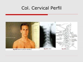 Col. Cervical Perfil
 