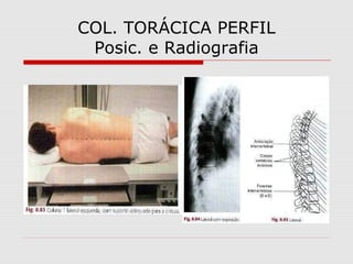COL. TORÁCICA PERFIL
Posic. e Radiografia
 