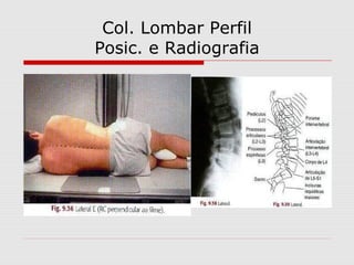 Col. Lombar Perfil
Posic. e Radiografia
 