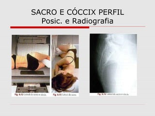 SACRO E CÓCCIX PERFIL
Posic. e Radiografia
 