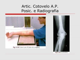 Artic. Cotovelo A.P.
Posic. e Radiografia
 