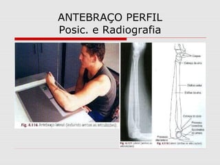 ANTEBRAÇO PERFIL
Posic. e Radiografia
 